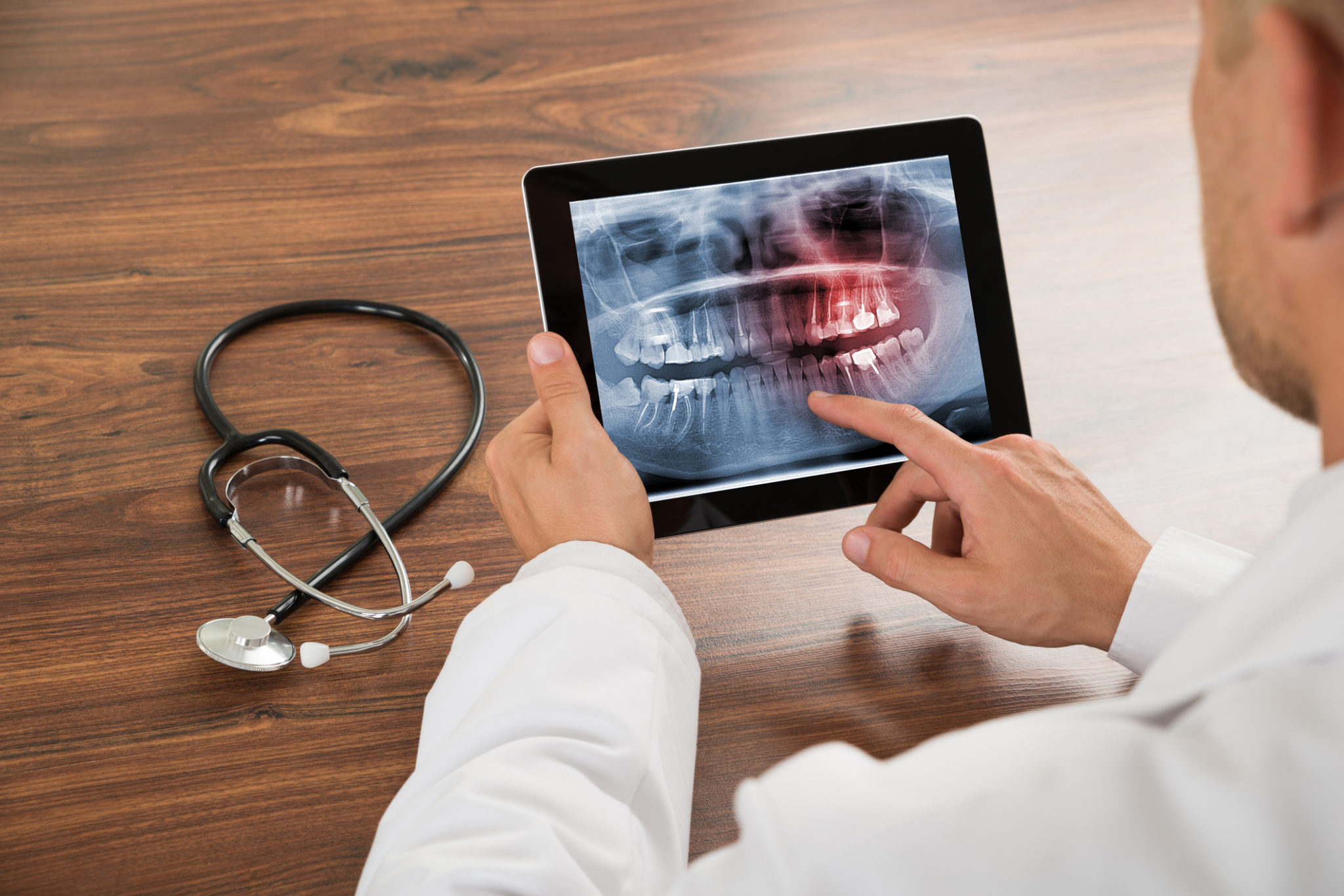 Doctor Looking At Human Teeth X-ray dental filling allentown pa dentist